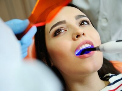 Dental Filling