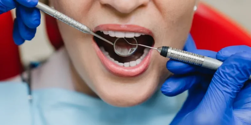 Root Canal Recovery